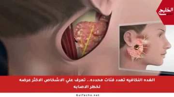 الغدة النكافية تهدد فئات محددة.. تعرف على الأشخاص الأكثر عرضة لخطر الإصابة